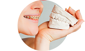 Лечение взрослых у ортодонта